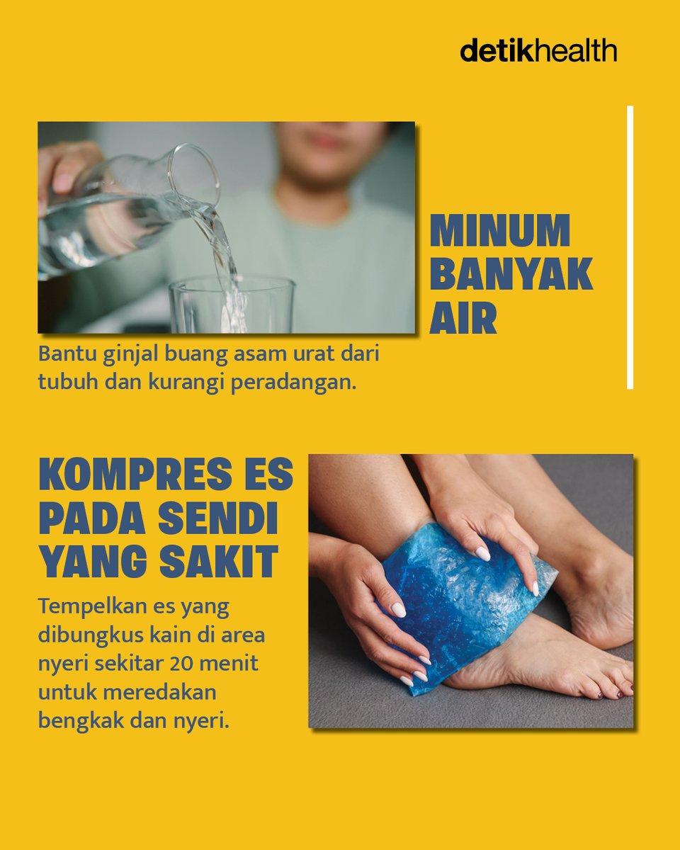 detikHealth's tweet photo. Kaki tiba-tiba nyeri banget? Bisa jadi itu serangan asam urat yang bikin aktivitas terganggu!
Yuk cobain deretan cara sederhana ini untuk meredakannya dulu di rumah. Sudah pernah ngerasain? Ceritain di kolom komentar ya! 🦶
#AsamUrat #Kesehatan #InfoSehat #Penyakit #detikhealth