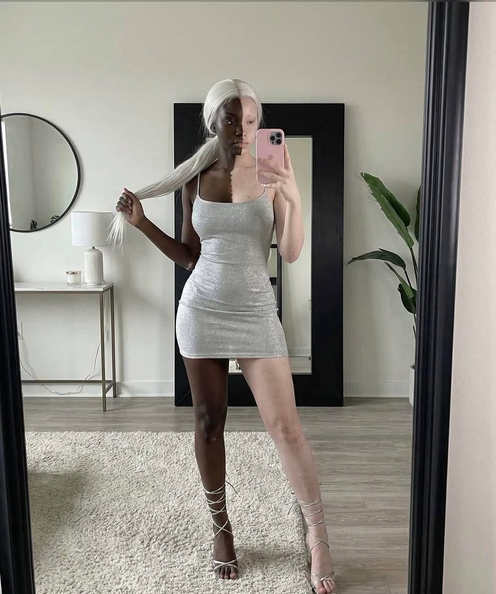 TryBomb's tweet image. Don't be scared, take a breather.
Vitiligo is real.