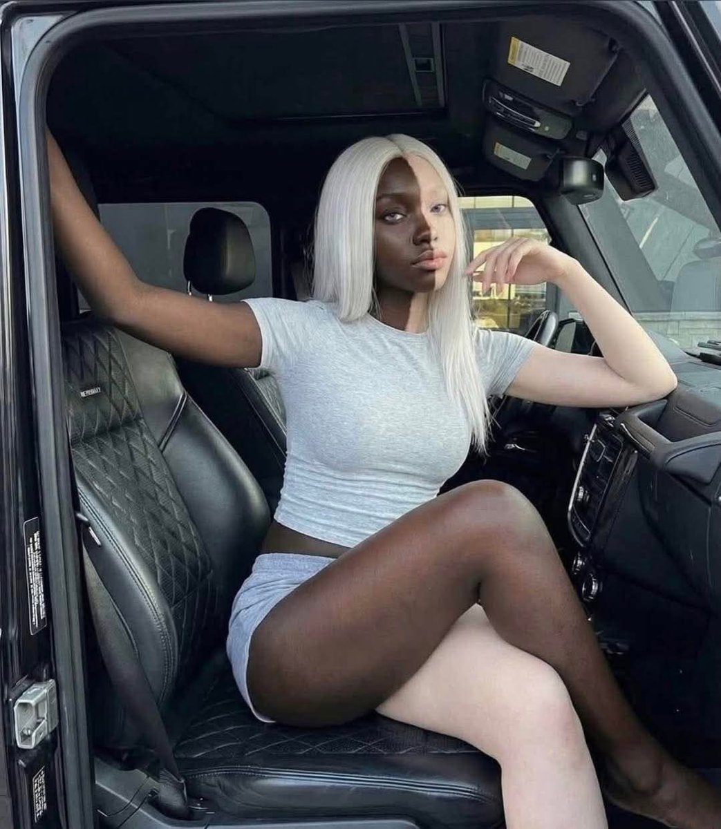 TryBomb's tweet image. Don't be scared, take a breather.
Vitiligo is real.