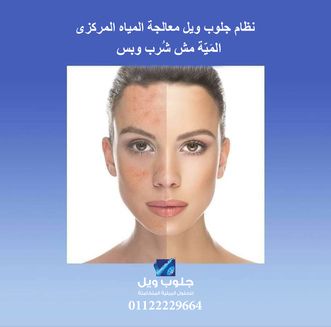 globewell1's tweet photo. بشرة صحية تبدأ من المياه اللي بتلمسها كل يوم
-مياه معالجة تقلل جفاف البشرة والتهيج
-تقليل الحبوب والحساسية
-حماية من آثار الأملاح والكلور
-نعومة وإشراقة طبيعية للبشرة
نظام معالجة المياه المركزي من جلوب ويل يمنحك بشرة أنعم وأفضل مع كل استخدام
لأن #المياه_مش_شرب_وبس
📞 01122229664 https://t.co/H2CenDOCDP
