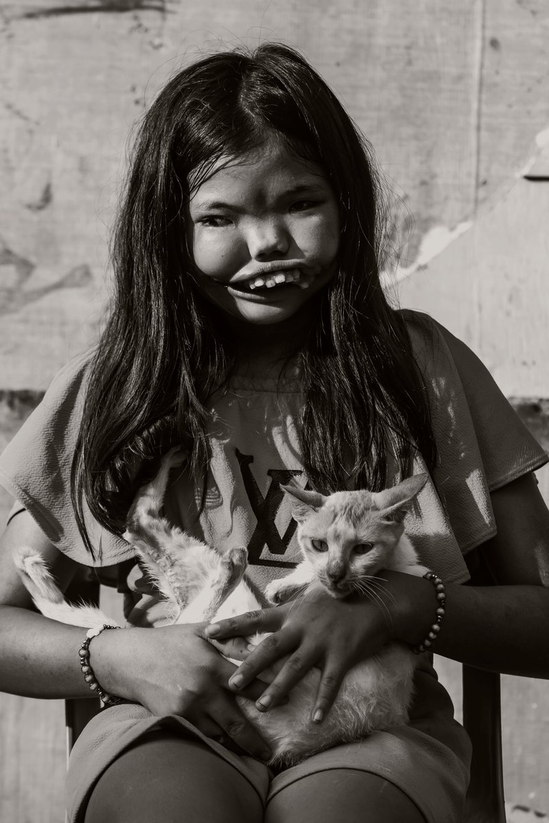 marklinelp's tweet photo. "Portrait of the Unseen"

Nicole, a young girl from Cebu, once felt ashamed to be photographed due to her facial deformity. In her faith, I saw my own journey after facial palsy—reminded that healing begins with self-acceptance and honoring one’s worth.

#Hasselbladmasters2026 https://t.co/PVp3yBMA3V