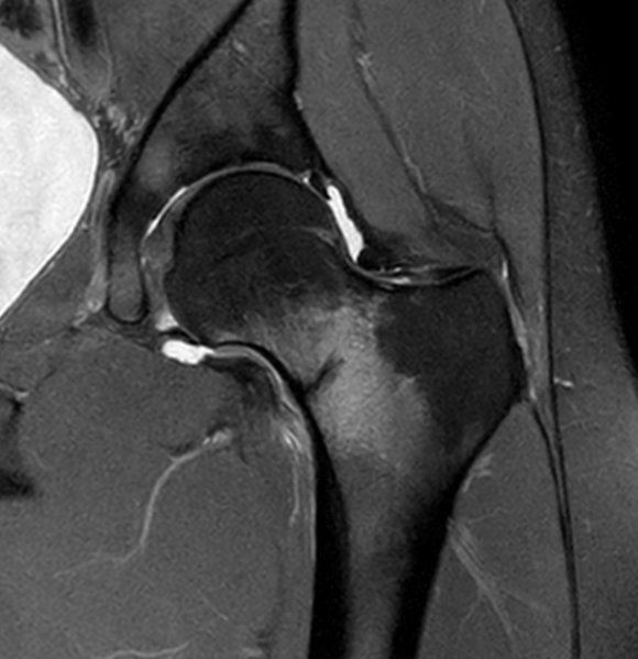 Jay Gajera tweet media