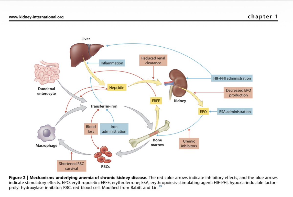 elba_vanessa's tweet image. Guarda este post! ✅

💾 Resumen clave sobre el manejo de la Anemia en Enfermedad Renal Crónica (ERC) basado en las guías KDIGO 2026. 👇

📌ANEMIA y ENFERMEDAD RENAL

🩸 1. ¿QUÉ ES Y POR QUÉ IMPORTA?

Es una complicación frecuente que aumenta la mortalidad y reduce la calidad de…