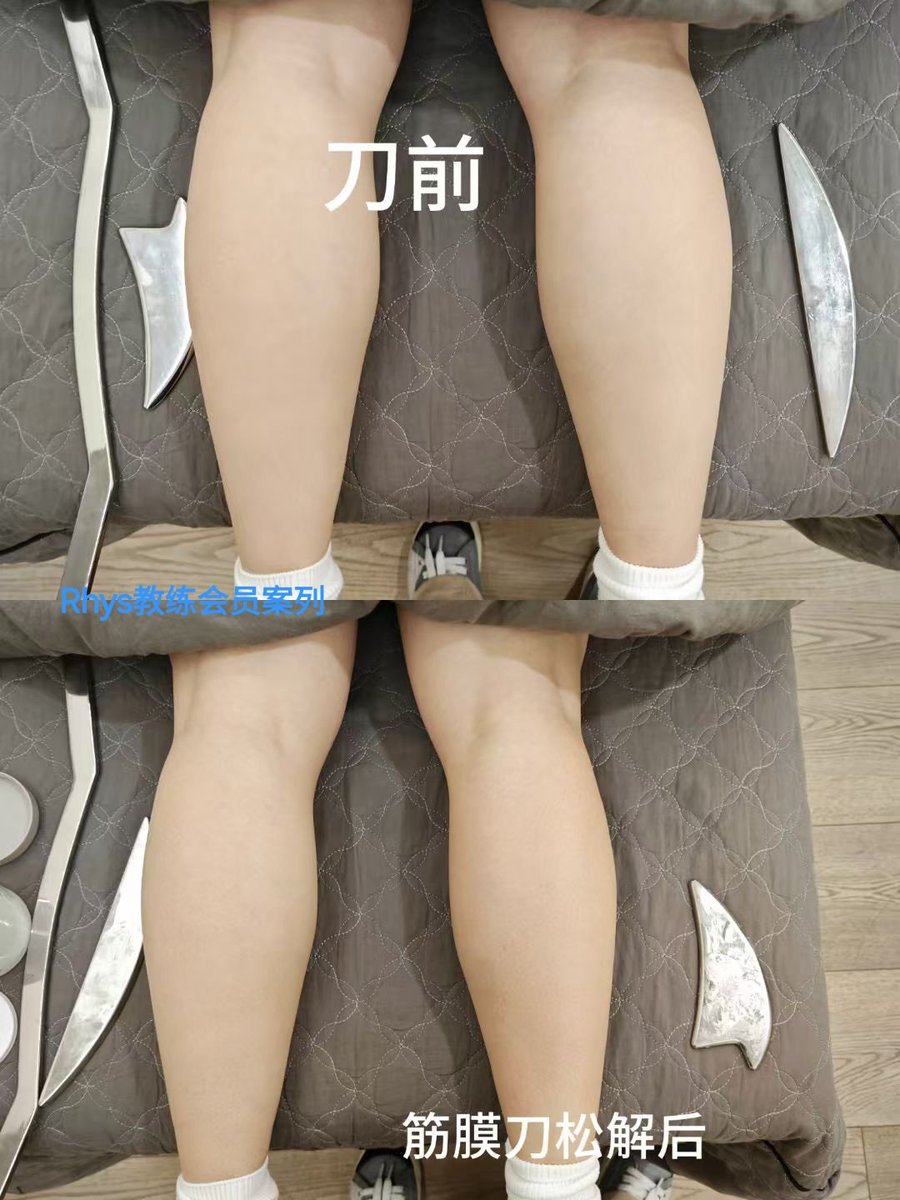 JackS37850's tweet photo. 营口自由教练上门按摩，筋膜刀，健身指导 https://t.co/Ca76icpmD8