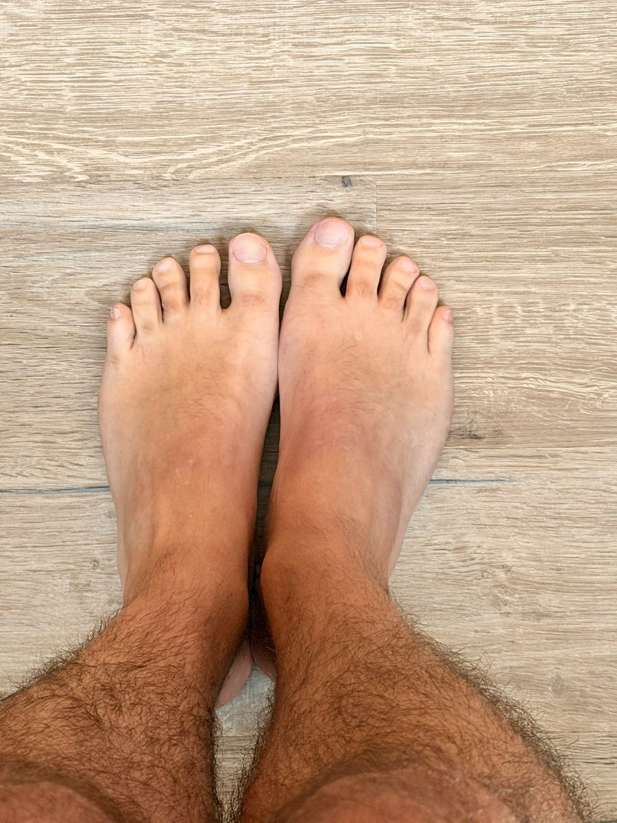 DTsecondacc's tweet photo. Money makers?

 #feetfetısh #footfetısh #footworship #feetworship #feet #feetlovers https://t.co/0wSphICvvo