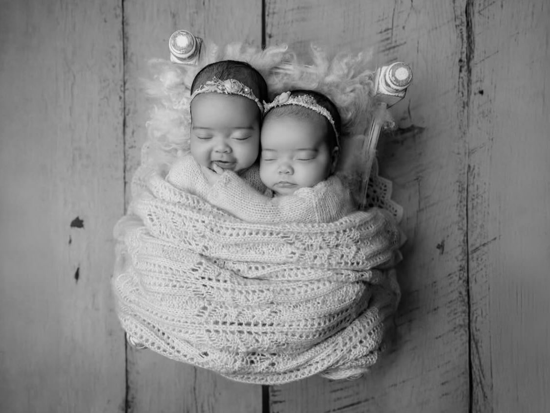 JesyNBR's tweet image. Jesy revelou através do seu Instagram que suas filhas foram diagnosticadas com Atrofia Muscular Espinhal tipo 1, a forma mais grave dessa doença rara. Os médicos disseram que as filhas provavelmente nunca poderão caminhar e não recuperarão força no pescoço.