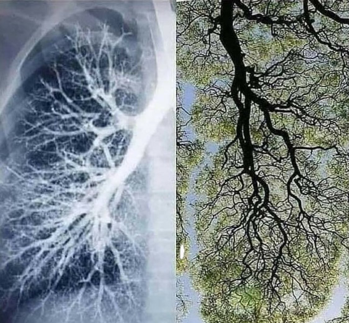 churchtalkative's tweet image. Left side is a human lung. Right side is a tree.

The tree breathes in what the lung breathes out. The lung breathes in what the tree breathes out.

God's design is incredible.