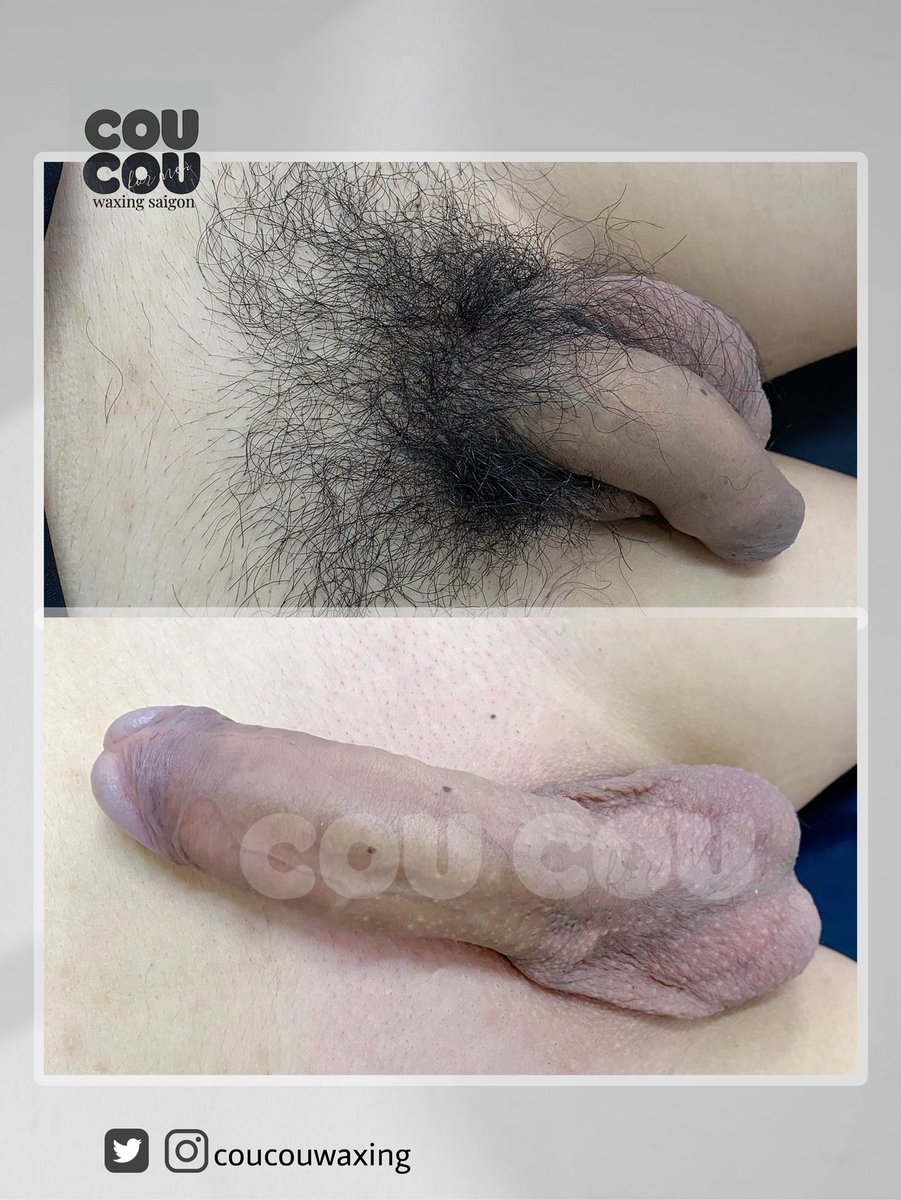 couwaxing's tweet photo. Sạch bi cho anh trai. Sạch lông láng mịn bù khu hơi bị ngon. 

COUCOU
waxing saigon

#contrainenbiet #waxing #formen #saigon #contrai #lamdep #selfcare #waxlong 

IG: coucouwaxing
X: coucouwaxing https://t.co/jC5pQXTfdZ