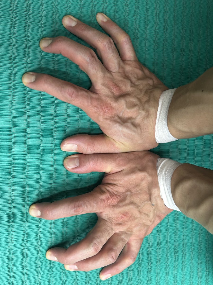 pizzaenemy's tweet image. ピザエネのフォロワーさんにだけ教えちゃう！
このガジュマルの木の画像を待ち受けにすると運気が上がるらしいからやってみてね👇🍕

明日から仕事、頑張っていこう✨