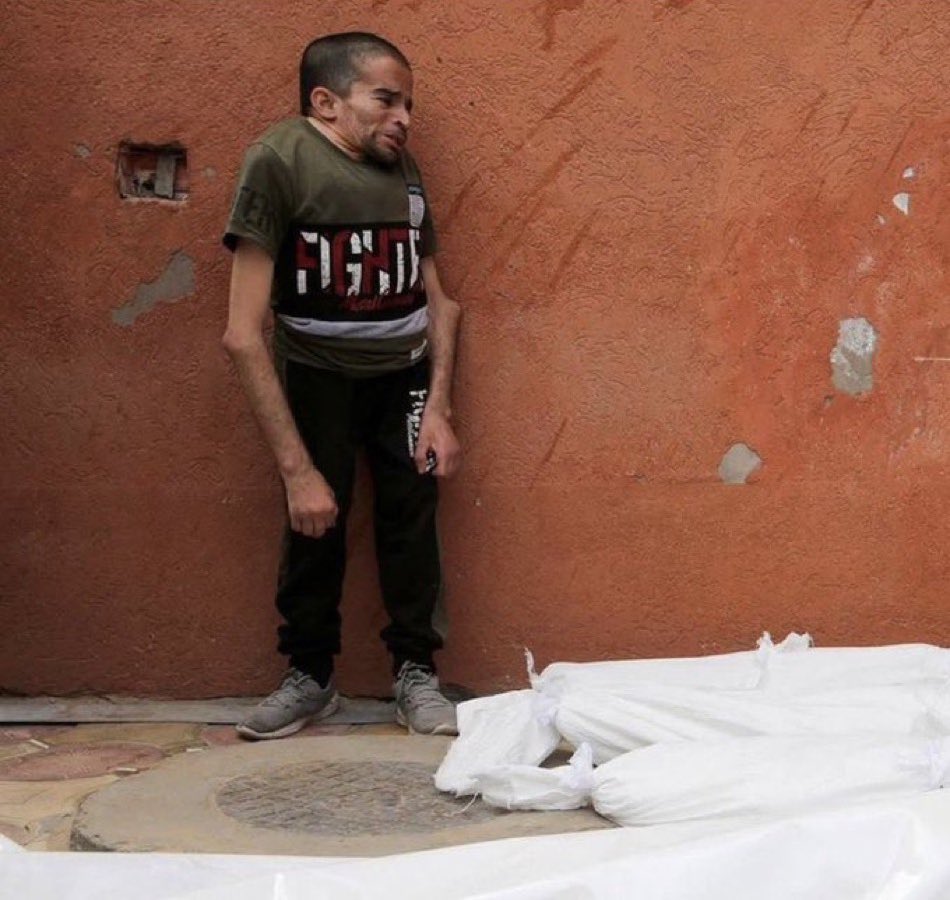 Yousefasultan1's tweet photo. In a narrow corner of this world,a human being stands،weighed down by war more than the body can bear.A silent wall,a weary ground,and pain that finds no place to escape. Here, in Gaza,loss is not measured only by what has fallen,but by what remains standing despite all this pain https://t.co/OwGjDEiwX6