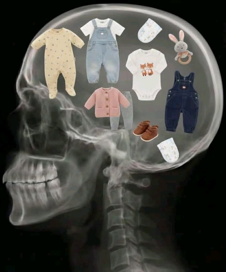 عقلي من يوم ما خلفت🫣😂