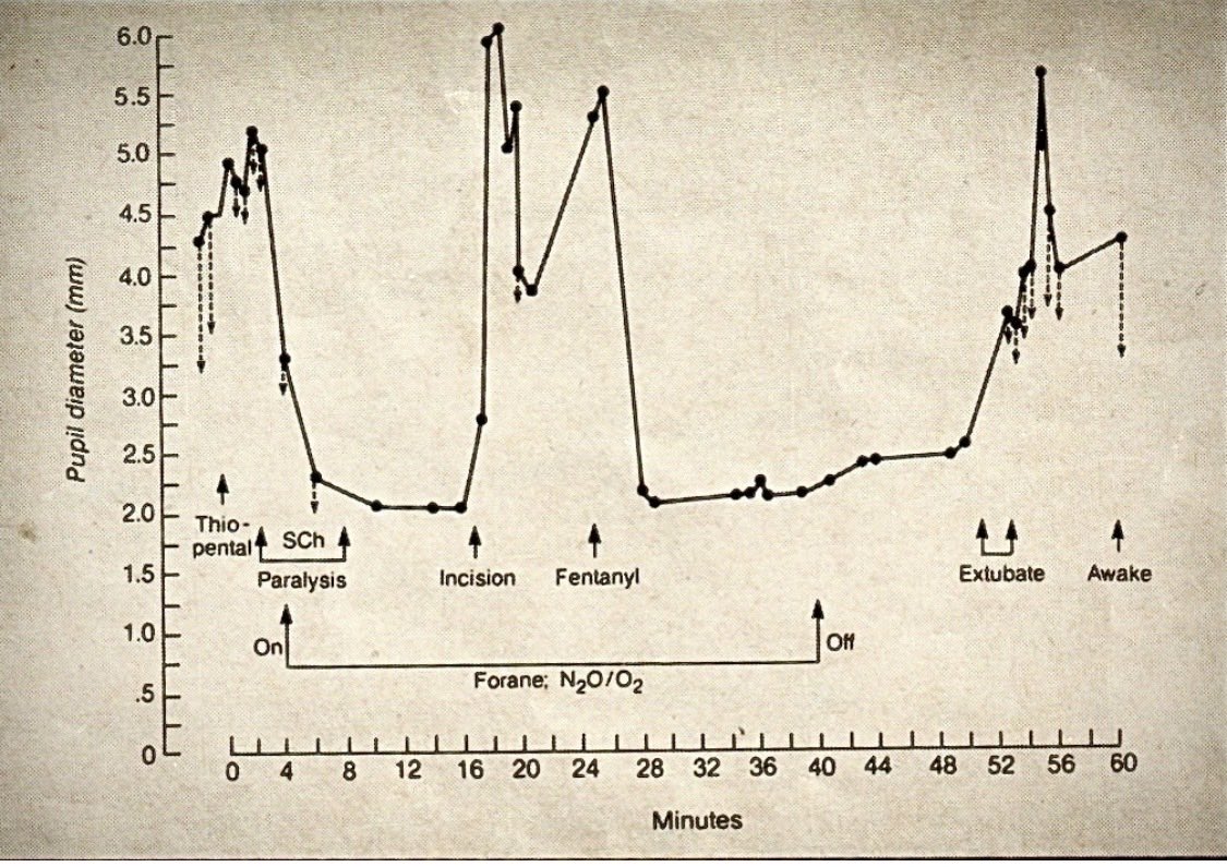 Merlin Larson, MD tweet media