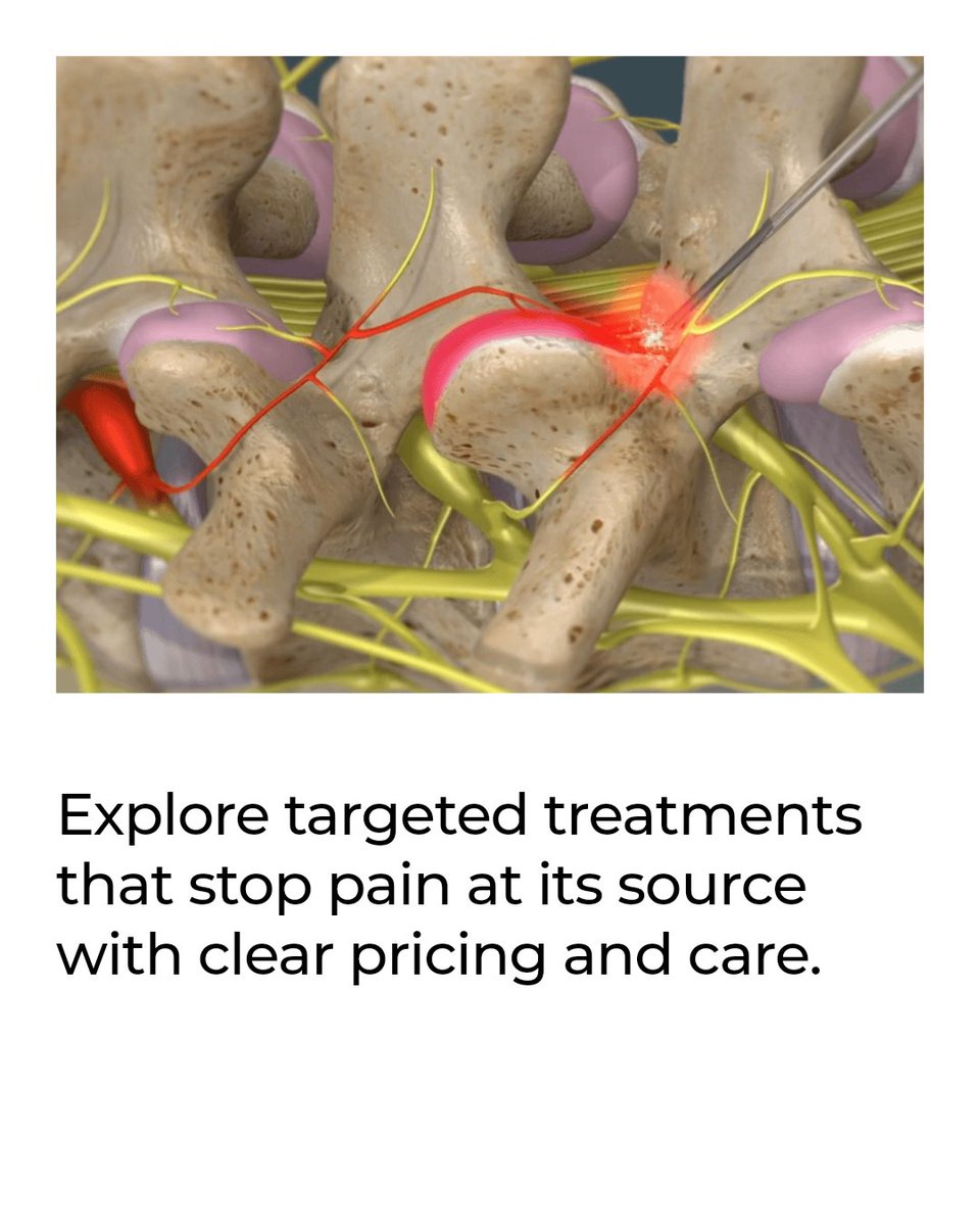 Chronic pain doesn't require surgery or endless meds. MSK Direct offers non-surgical options like mPNS, PRP, and shockwave therapy. Target pain at its source with transparent pricing and personalized care. Restore your function today.