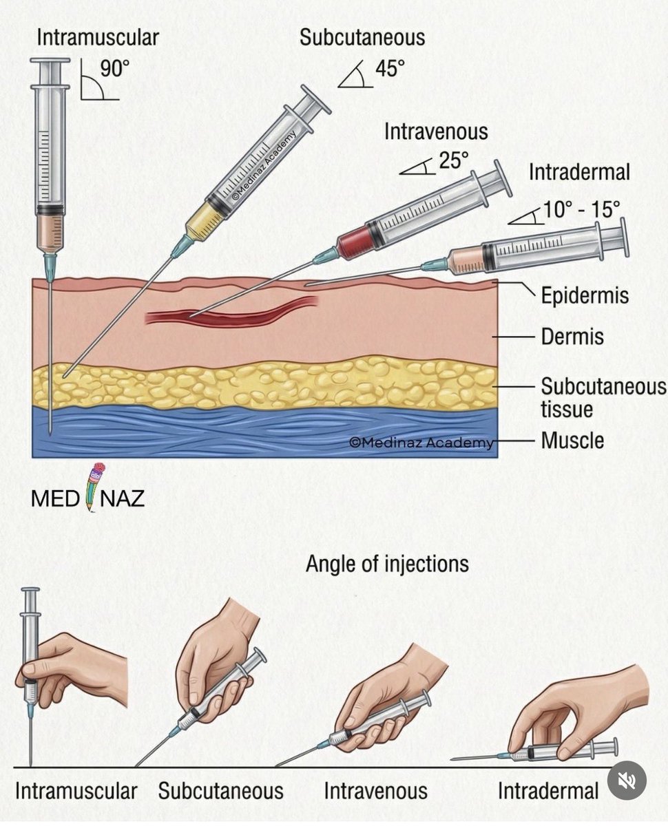 TodayiLearrned's tweet photo. Angel of injections https://t.co/jvnI4grh2J