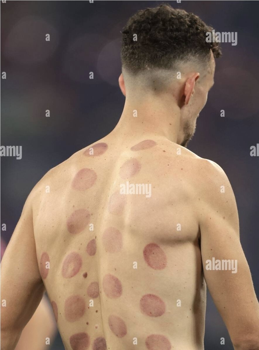 KimCrienen's tweet photo. @DStofzuiger @m_wijffelsAD "Cupping" volgens mij. Zie je ook vaker bij Perisic. https://t.co/BHTASpCqB3
