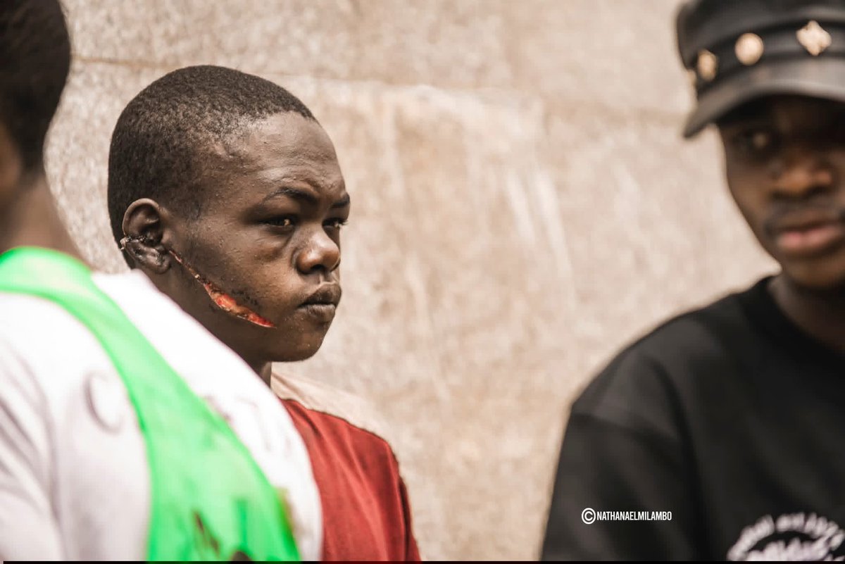 ngalulajael1's tweet image. Des enfants abandonnés grandissent dans la rue.
Ils apprennent à survivre, pas à aimer.
Ignorer l’enfance, c’est fabriquer des adultes en colère.
Protéger les enfants n’est pas un luxe, c’est urgent.