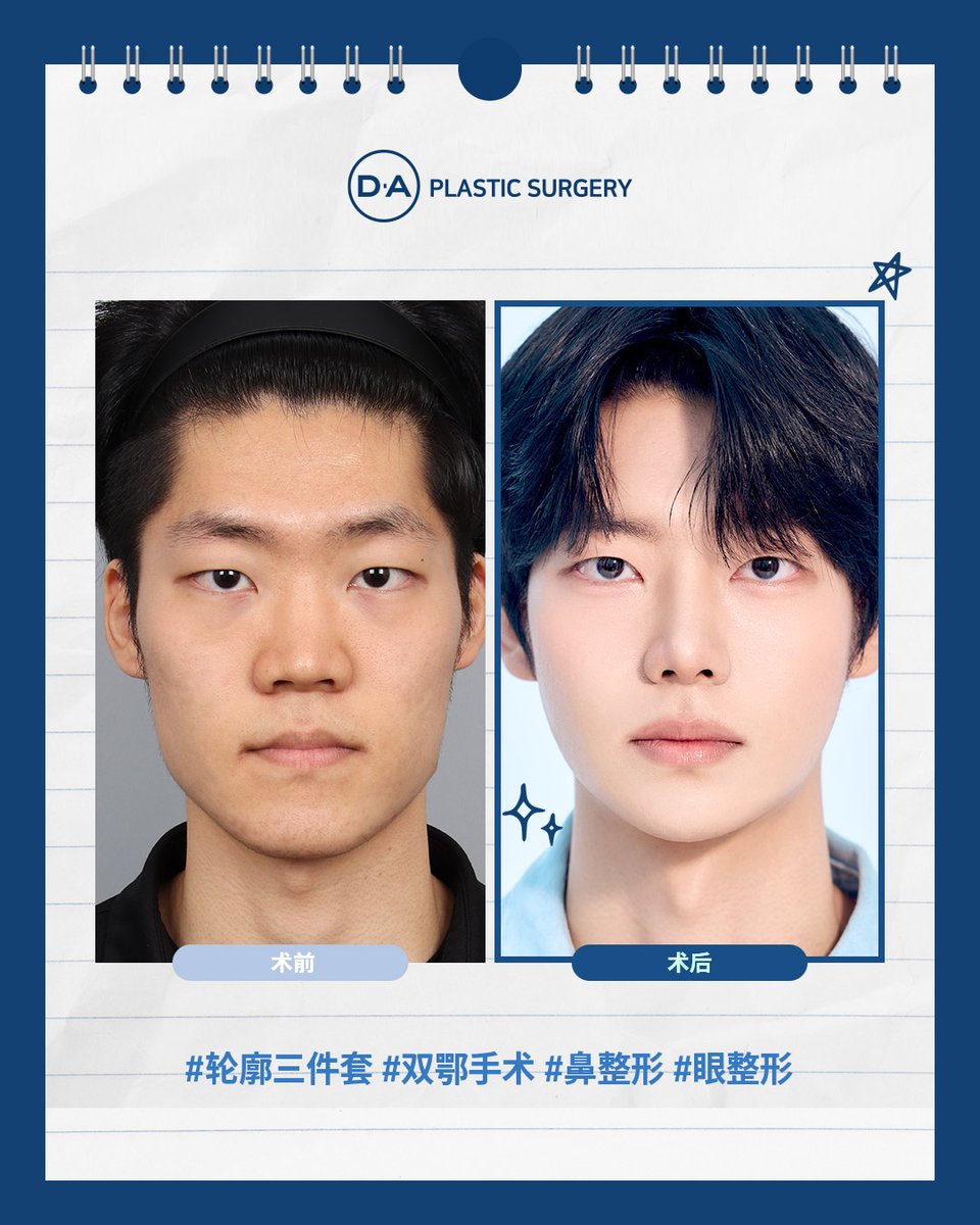 광섬유 UAV/FPV 드론이란 무엇일까요? 종합 가이드 : Fiber-Mart.com, image size:960x1200