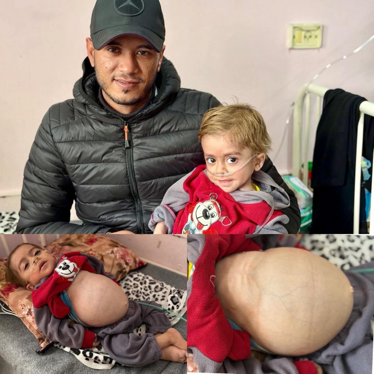 TERKINI 

IDF menangkap bapa kepada kanak kanak Gaza yang sakit iaitu Karim Ali Fouad Abu Muammar, 

Ketika itu bapanya sedang menemani anaknya yang bakal mendapatkan rawatan di Türkiye melalui Lintasan Kerem Shalom 

Nasib bapanya tidak diketahui sehingga kini dan keluarganya