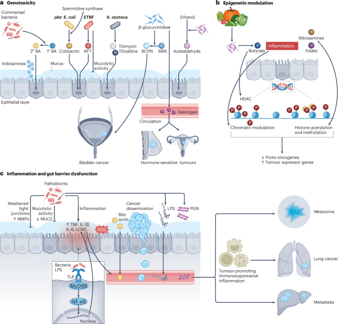 NatureRevMicro's tweet photo. New online! Harnessing the microbiome for cancer therapy https://t.co/XNp9dNeEBb https://t.co/2mOwULB2Fk