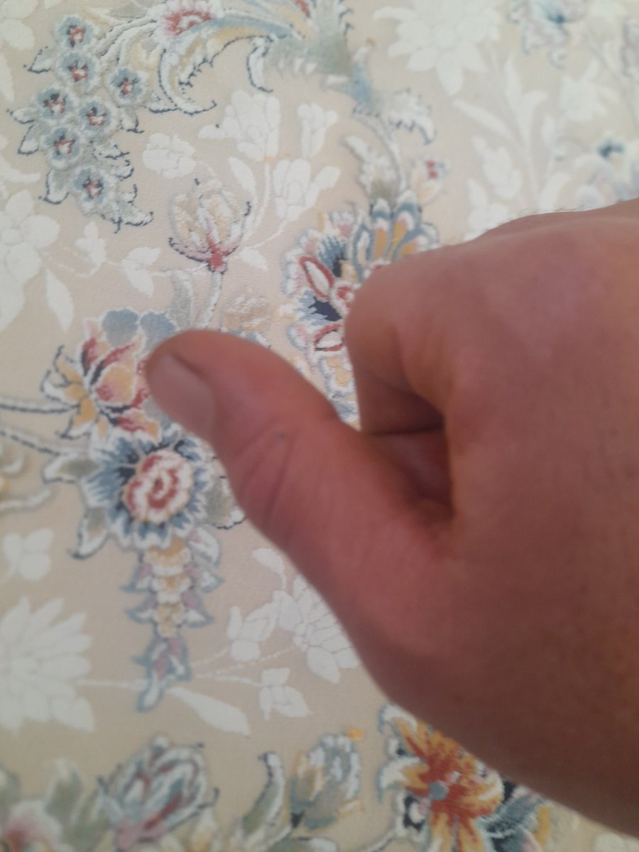 انگشت شصت دست راستم توی اعتراضات شب ششم خرم آباد به ضرب باتوم نیروهای سرکوب گر شکسته، دو روزه از درد به خودم میپیچم و جرات هم نمیکنم ببرم بیمارستان چون سابقه سیاسی دارم.
فعالین پاپلیک در این منطقه اگر درمانگر انقلابی میشناسید که امن باشه، لینک کنید ببرم گچ بگیرم. ممنون