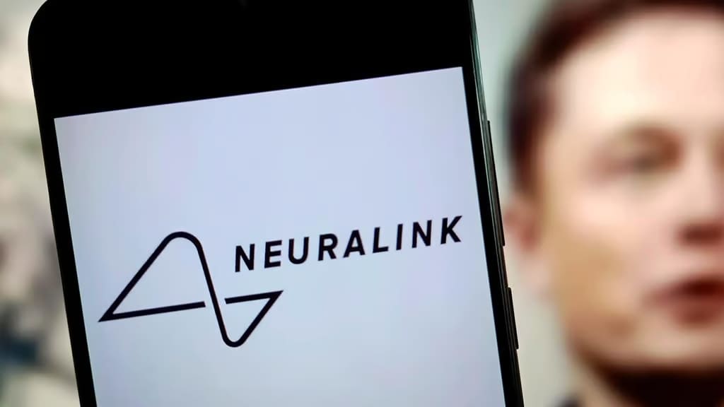 SocialandTech's tweet image. Neuralink verso la produzione di massa: i chip cerebrali di Musk diventeranno realtà nel 2026 socialandtech.net/neuralink-vers… 

#Neuralink @elonmusk