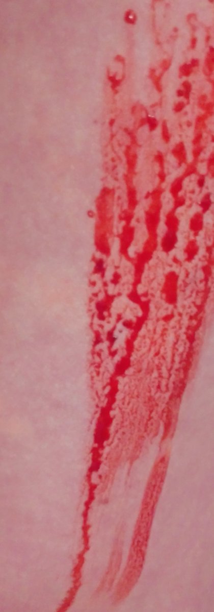 Аннушка 🩹 tweet media