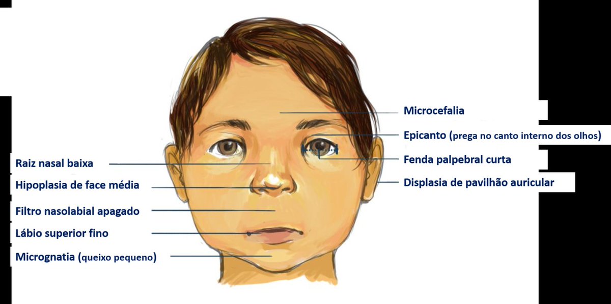 Careca de Ratanabá tweet media