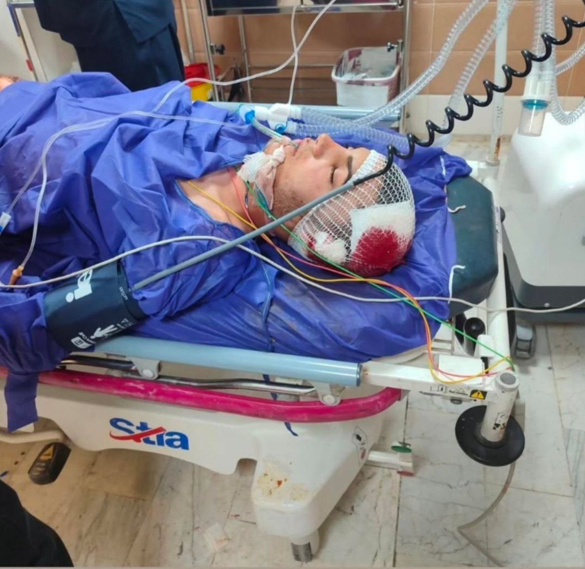 #رضا_مرادی، فرزند بهروز مرادی، معترضی که در اعتراضات شهر #ازنا بر اثر شدت جراحات به سرش در بیمارستان بستری بود، صبح امروز جان سپرد.