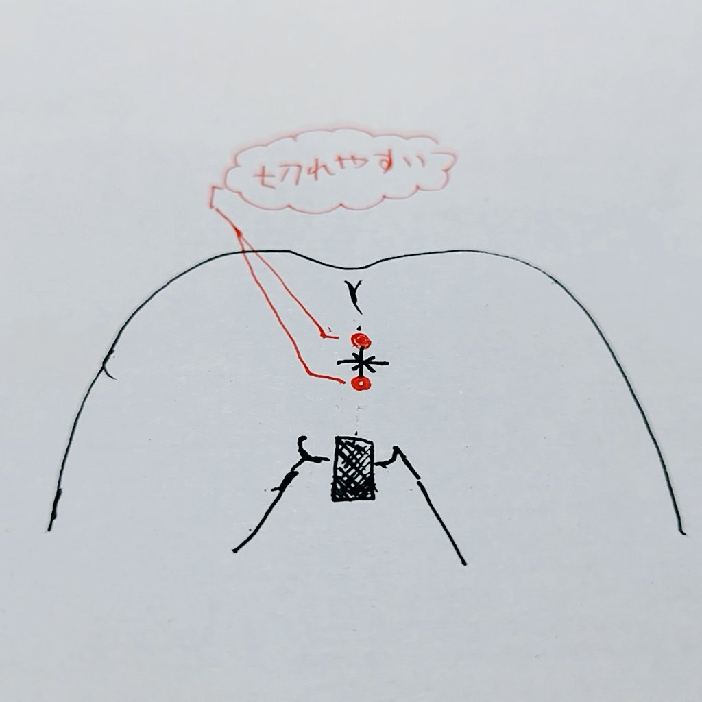 cd_iku12121's tweet photo. ①肛門を使用する紳士諸君は
『お尻で遊ぶとココがいつも切れやすいんだよな』
という悩みを持つ方がいらっしゃると思いますが、これは「肛門狭窄」といって切れて治った部分は組織が変異し硬化しやすくなる為
次第に伸縮性を失い狭くなる事が多いため、治ってもまたその硬化した部分が切れやすい↓ https://t.co/whW5E67JCp