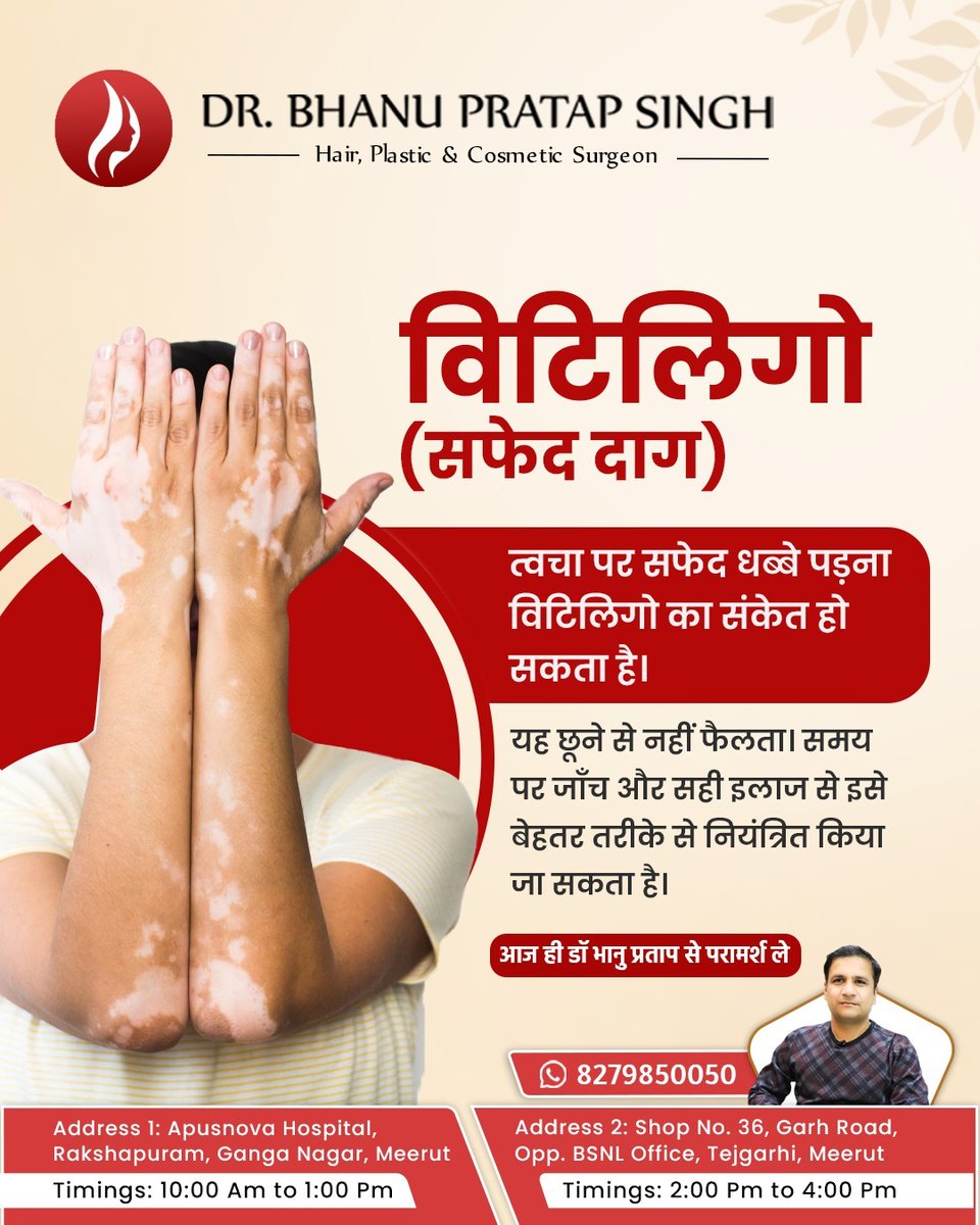 Dr_Bhanu_Pratap's tweet image. 𝐕𝐢𝐭𝐢𝐥𝐢𝐠𝐨 𝐜𝐚𝐮𝐬𝐞𝐬 𝐰𝐡𝐢𝐭𝐞 𝐩𝐚𝐭𝐜𝐡𝐞𝐬 𝐨𝐧 𝐬𝐤𝐢𝐧, 𝐢𝐬 𝐧𝐨𝐭 𝐜𝐨𝐧𝐭𝐚𝐠𝐢𝐨𝐮𝐬, 𝐚𝐧𝐝 𝐜𝐚𝐧 𝐛𝐞 𝐞𝐟𝐟𝐞𝐜𝐭𝐢𝐯𝐞𝐥𝐲 𝐦𝐚𝐧𝐚𝐠𝐞𝐝 𝐰𝐢𝐭𝐡 𝐭𝐢𝐦𝐞𝐥𝐲 𝐝𝐢𝐚𝐠𝐧𝐨𝐬𝐢𝐬
.

#vitiligo #whitepatches #SkinAwareness #notcontagious