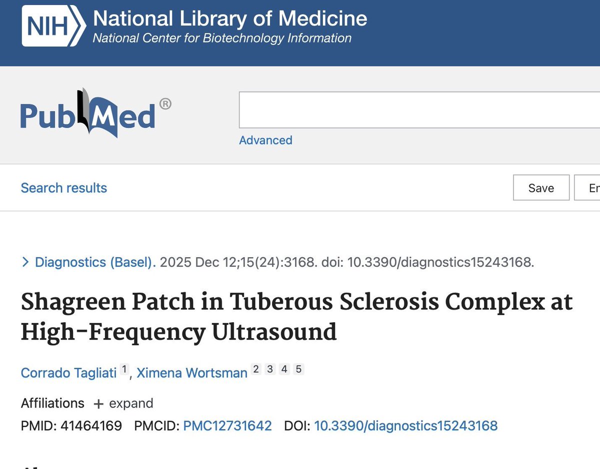 xworts's tweet photo. I’m very pleased to share our recently published case demonstrating the first reported ultrasound image ofa shagreen patch in Tuberous SclerosisComplex 🙌
Using high-frequency dermatologic ultrasound, wewere able to visualize characteristic dermal thickening and decreased echogenicity, providingnew insight into this important cutaneous sign. Thisreport reinforces how ultrasound can enhancedermatologic diagnosis and deepen our understandingof rare genodermatoses.
🧠 Why it matters: Shagreen patch is one of the major diagnostic criteriaof Tuberous Sclerosis Complex. Until now, itscharacteristics had never been documented withultrasound. This opens new possibilities for non-invasive assessment and improved clinicalcharacterization.
📄 Read the article here: Diagnostics (2025) — Shagreen Patch in Tuberous Sclerosis Complex at High-Frequency Ultrasound Authors: Corrado Tagliati & Ximena Wortsman
🔍 Advancing dermatologic ultrasound, one step at a time!
Reference: Tagliati C, Wortsman X. Shagreen Patch in Tuberous Sclerosis Complex at High-FrequencyUltrasound. Diagnostics (Basel). 2025 Dec12;15(24):3168. doi: 10.3390/diagnostics15243168. PMID: 41464169; PMCID: PMC12731642.
@xworts @sonoskin #dermatologicultrasound