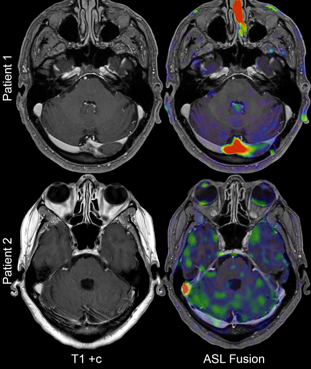Evan Calabrese, MD PhD tweet media