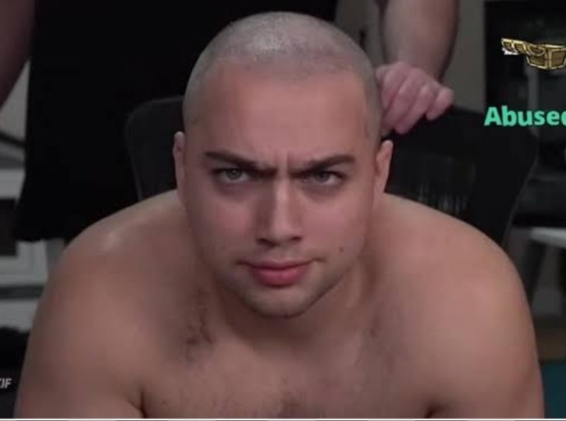 RouteClout's tweet image. Mizkif has to shave his head to start an honest journey to forgiveness. Especially after that bald abuse... 

🔗👇
