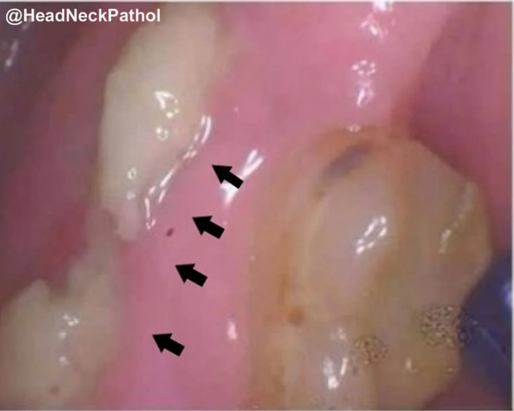 Lester Thompson tweet media