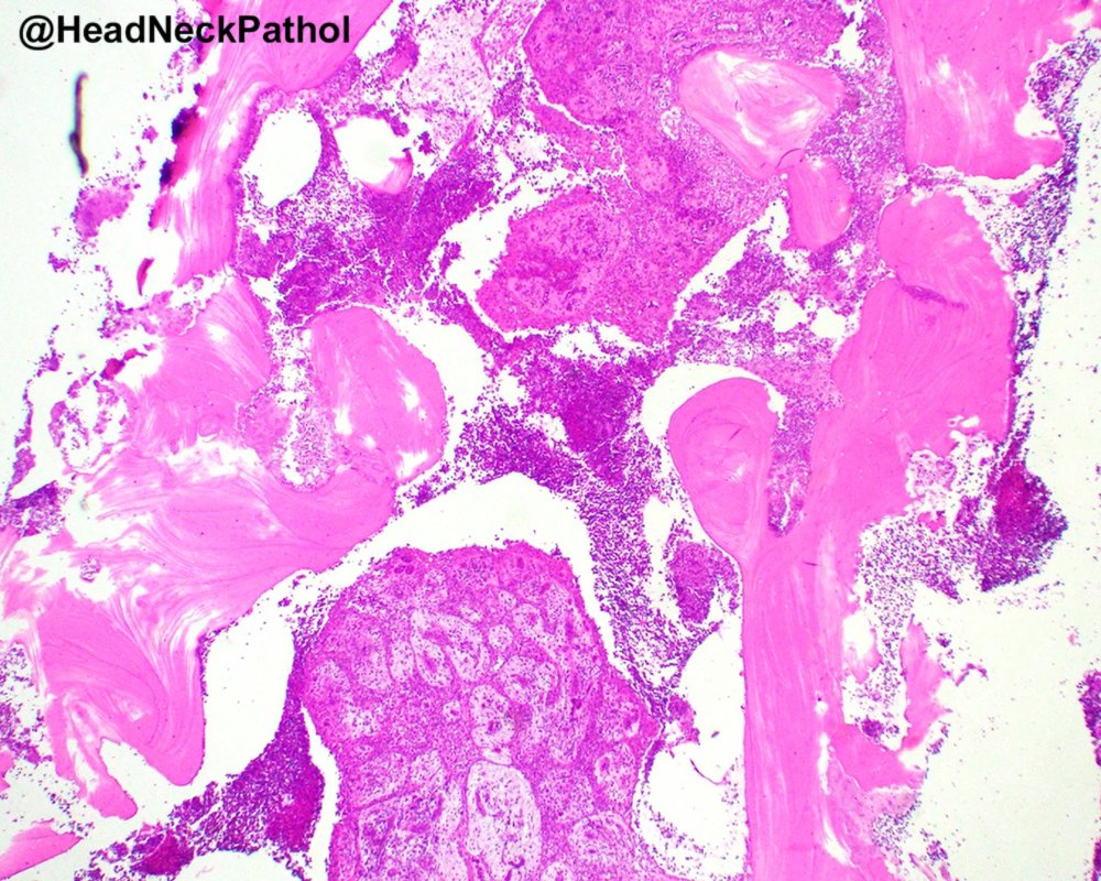 Lester Thompson tweet media