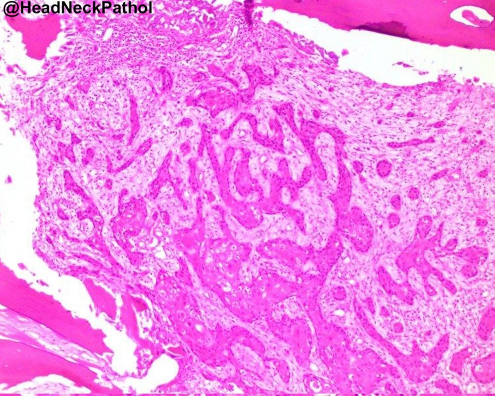 Head Neck Pathol tweet media