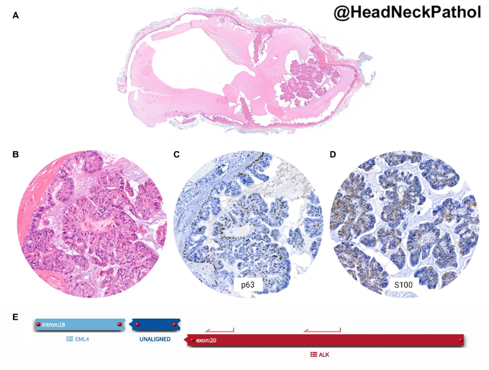 Head Neck Pathol tweet media