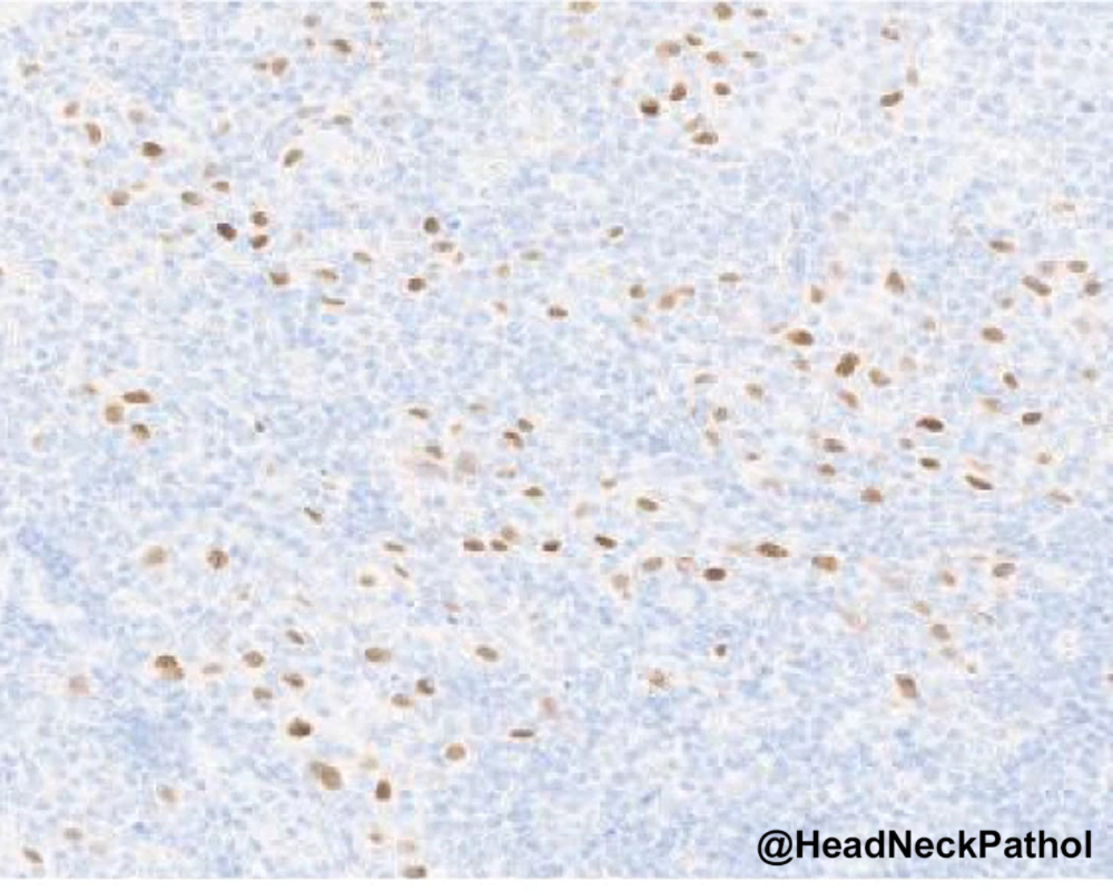 Lester Thompson tweet media