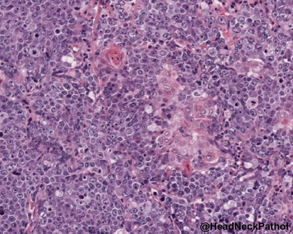 Lester Thompson tweet media