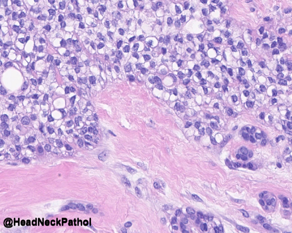 Lester Thompson tweet media