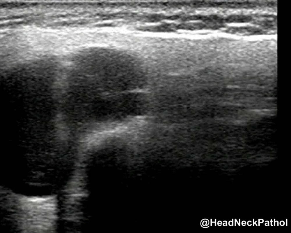 Head Neck Pathol tweet media