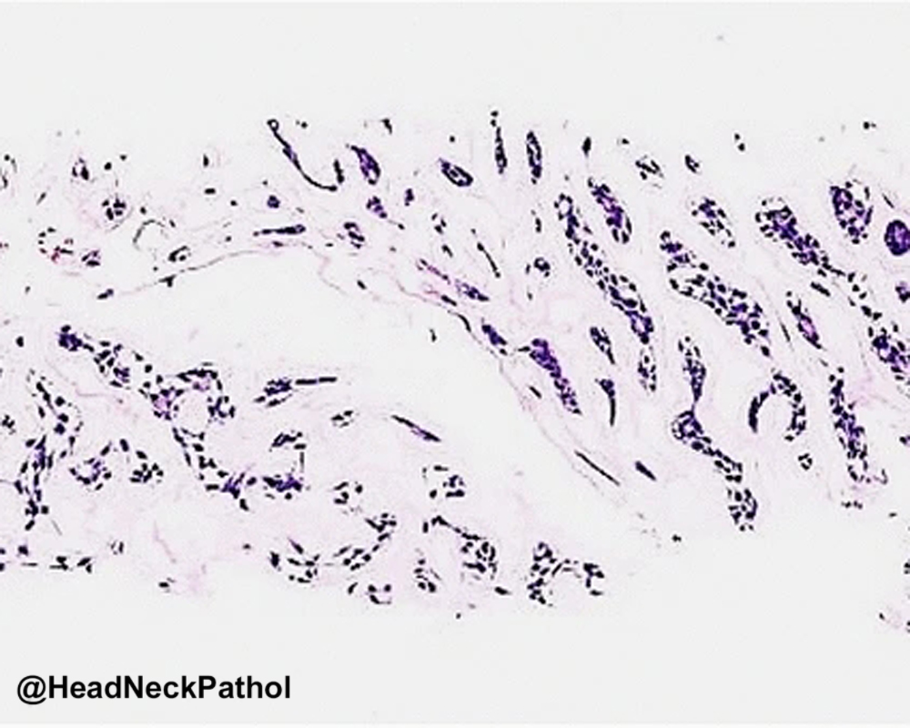 Head Neck Pathol tweet media
