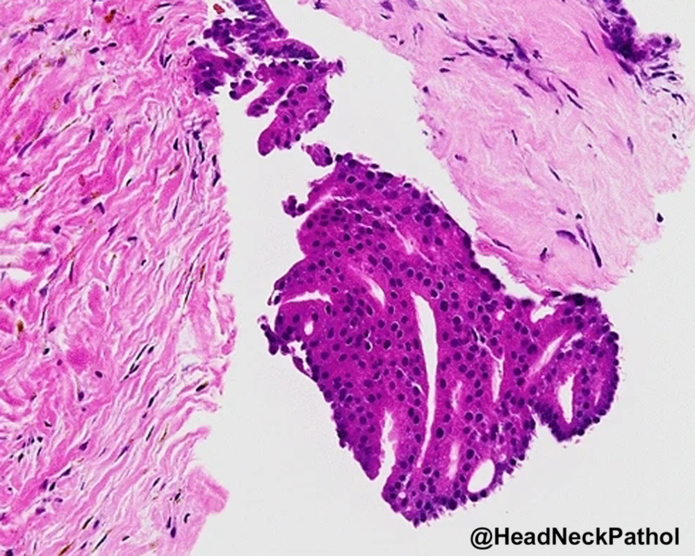 Head Neck Pathol tweet media