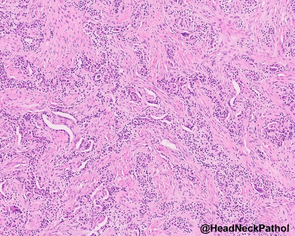 Lester Thompson tweet media