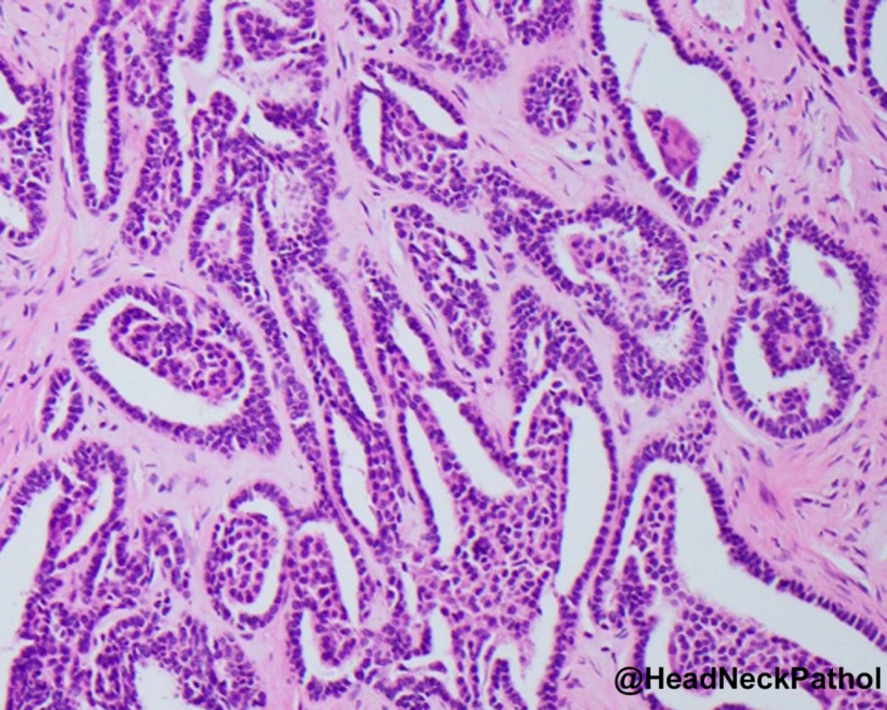 Head Neck Pathol tweet media