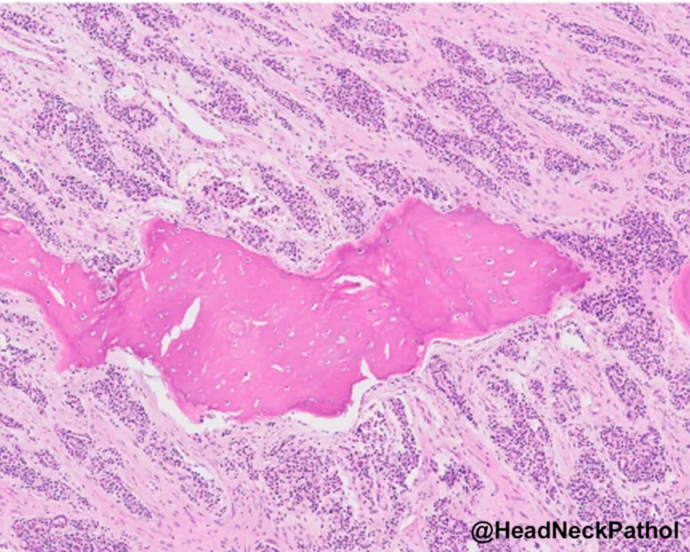 Head Neck Pathol tweet media