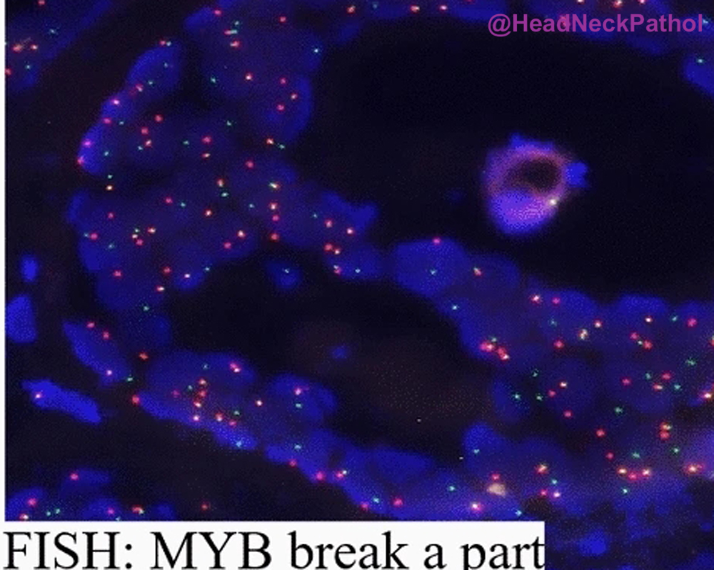 Lester Thompson tweet media