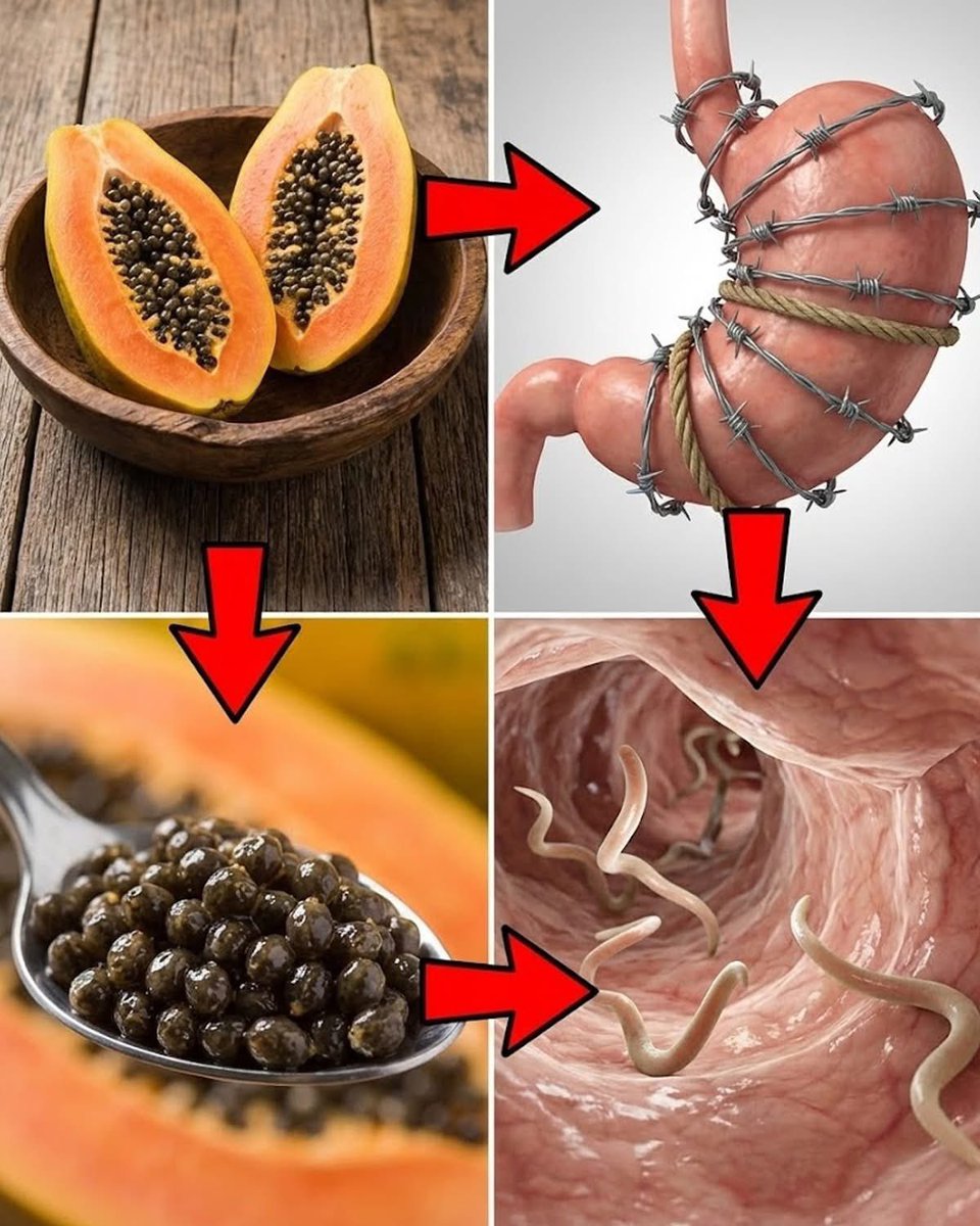 shyam_ayurved's tweet photo. 🍀Papaya Seeds: Nature’s Hidden Parasite Cleanser.🍀

🌸Support gut deworming 
🌸Improves digestion
🌸Fights harmful microbes
🌸Reduces bloating
🌸Boost liver detox

👉Chew 1 tbs dried papaya seed, or grind mix with honey once daily for seven days.

🔬Papaya seeds contain benzyl isothiocyanate & enzymes show in studies two in a bit intestinal parasites and support gut health naturally.