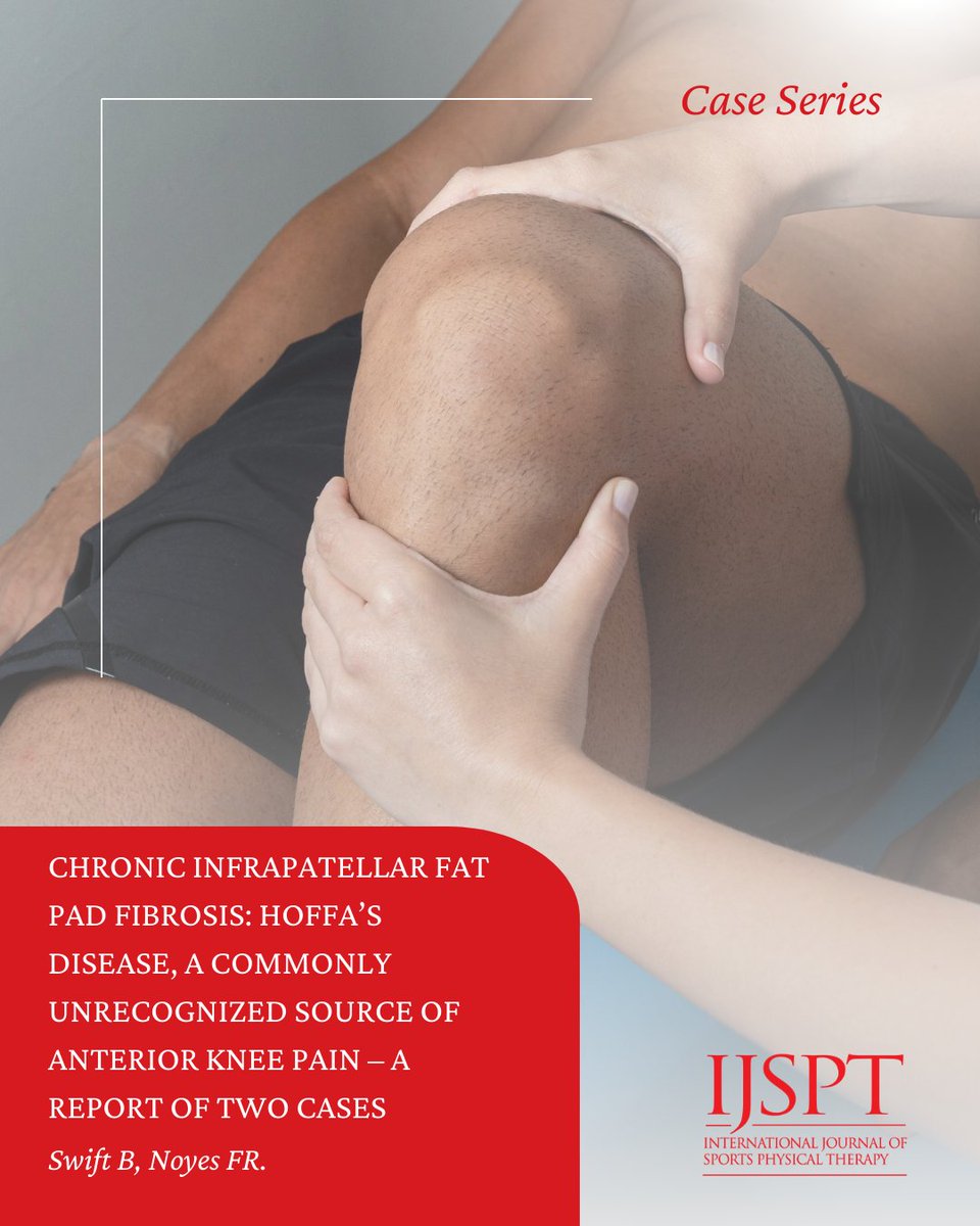 IJSPT's tweet image. Chronic fat pad fibrosis (#HoffasDisease) is an overlooked cause of anterior #KneePain. This case report details 2 surgical interventions that relieved symptoms. Read &amp;amp; share with your #Orthopedic or #SportsPT team: ijspt.scholasticahq.com/article/153923…