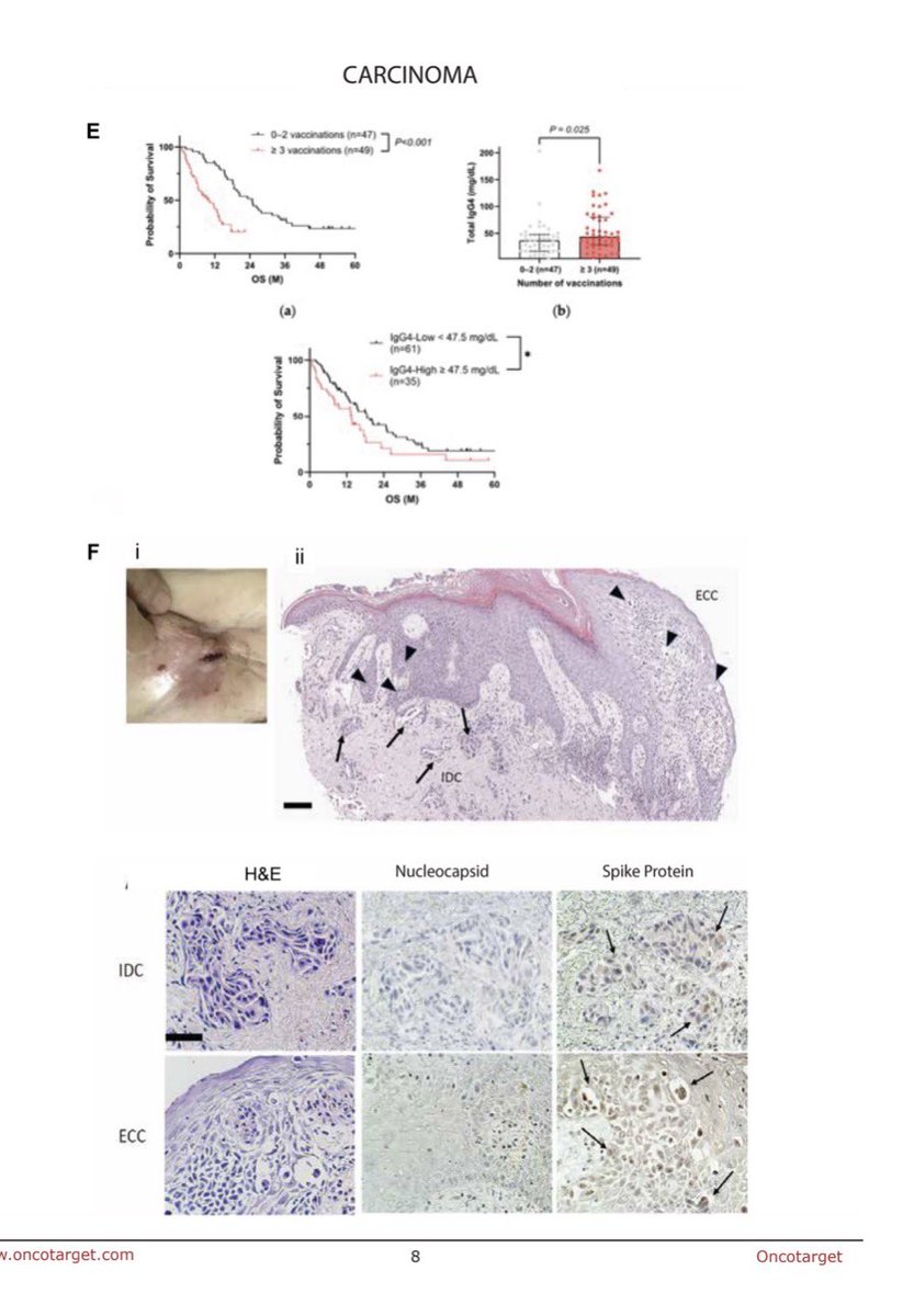 🚨【緊急拡散】ついに査読済み論文で「ターボ癌」が裏付けられました。

ニコラス・ハルシャー博士らが『Oncotarget』で発表したシステマティック・レビューによると、世界27ヶ国で333件の接種後癌発症が確認されました。

異常なのはそのスピードです。